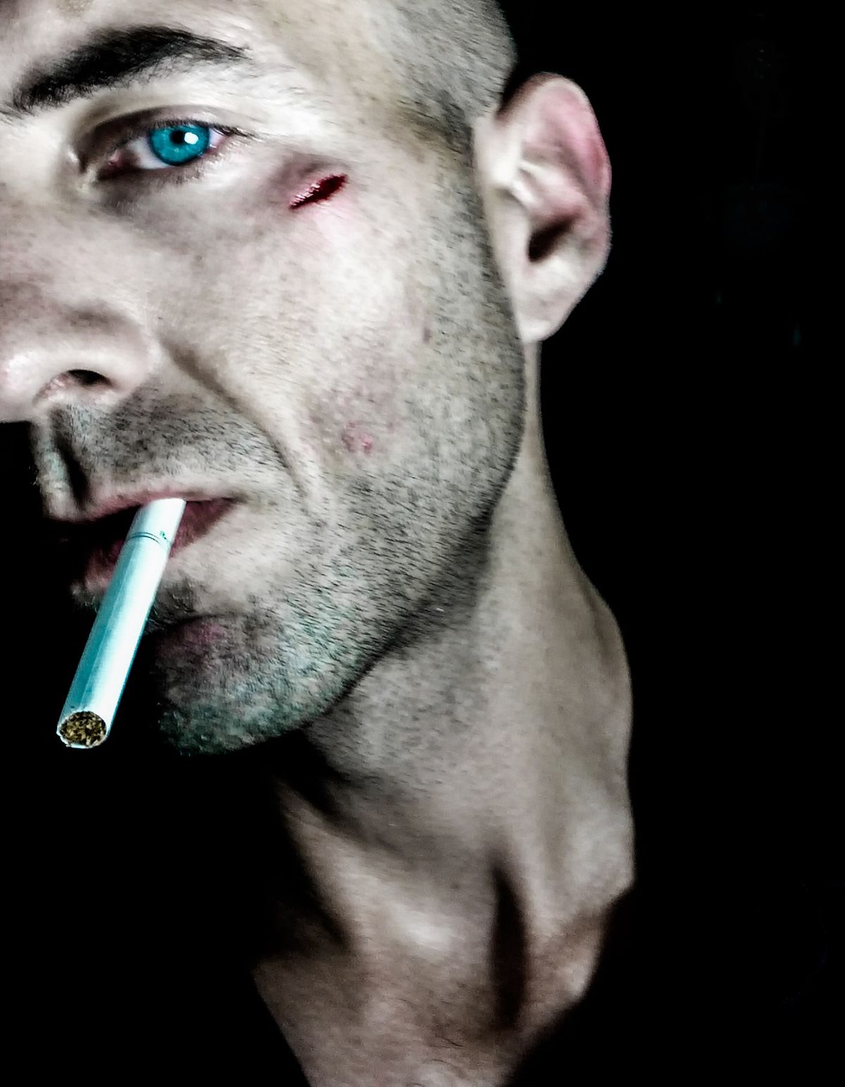Close-up portrait of a shaven-headed man with a cut beside his blue eye and a cigarette in his mouth, against black.